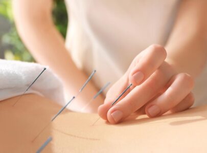 Receiving acupuncture for stress, anxiety or depression can be an important step in achieving lasting relief and help you lead a happy, healthy life.